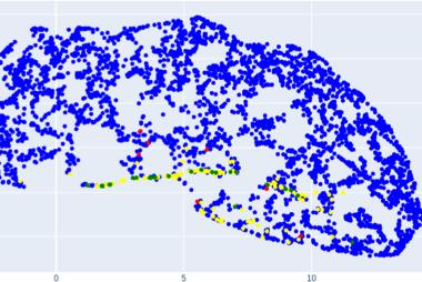 A graph showing colored dots representing: True Negative; False Positive; True Positive, False Negative